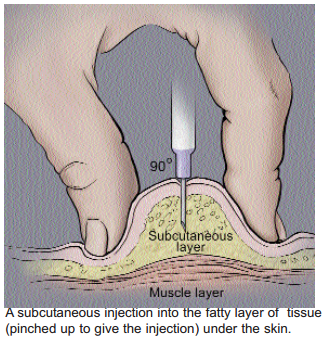 Subcutaneous_injection Subcutaneous_injection